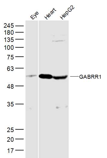 GABRR1 Rabbit pAb (一抗) | Bioss