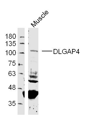 DLGAP4 Rabbit pAb (一抗) | Bioss