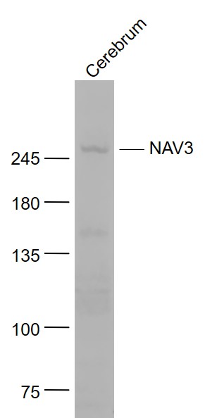 NAV3 Rabbit pAb (一抗) | Bioss