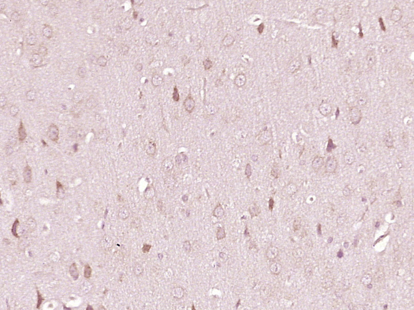 色氨酸羟化酶抗体-bs-1215R