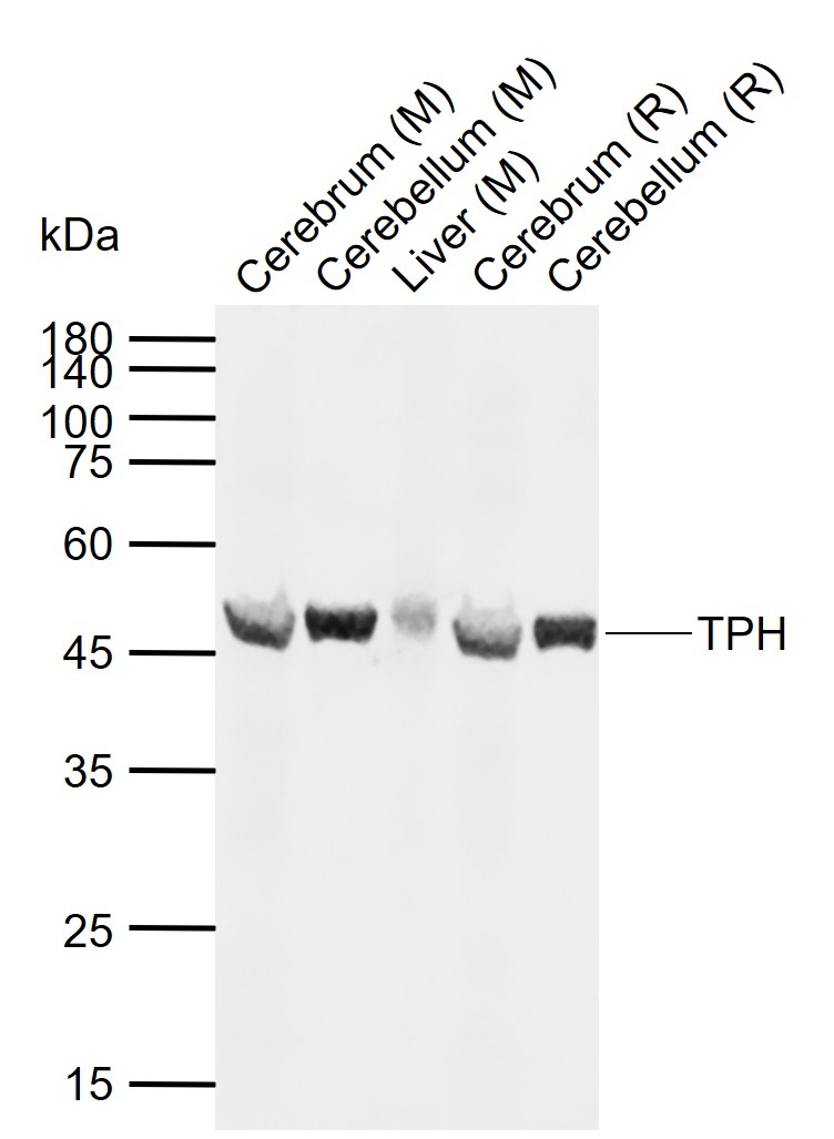 色氨酸羟化酶抗体-bs-1215R