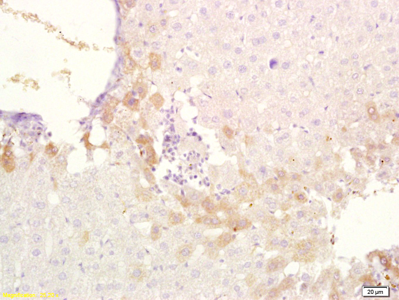 ABCB6 Rabbit pAb (一抗) - IHC-P,IHC-F,IF | Bioss