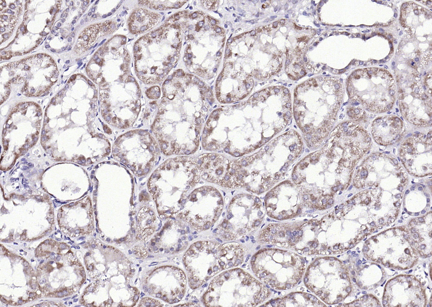 磷酸化血管生成素受体2抗体-bs-12262R