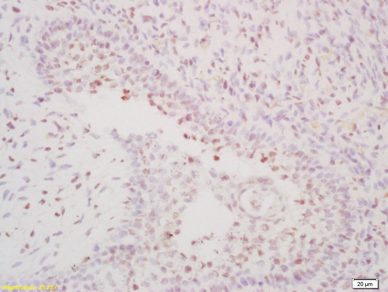 OSR1/OSR2蛋白抗体-bs-12377R