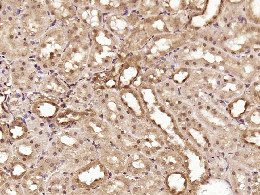 OSR1/OSR2蛋白抗体-bs-12377R