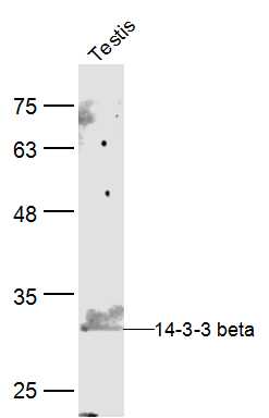 14-3-3 beta Rabbit pAb (一抗) | Bioss