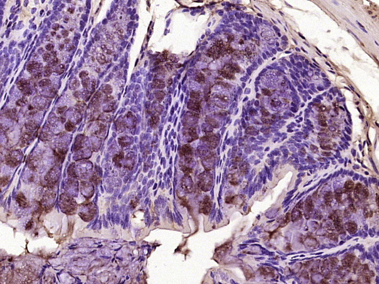 磷酸化腺瘤样息肉抗体-bs-12481R