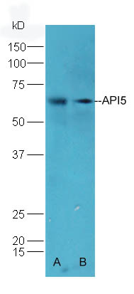 API5 Rabbit pAb (一抗) | Bioss