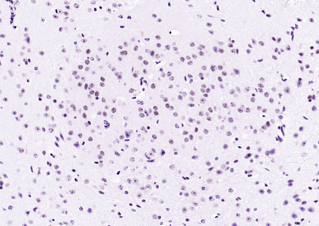 凋亡抑制因子5抗体-bs-1252R