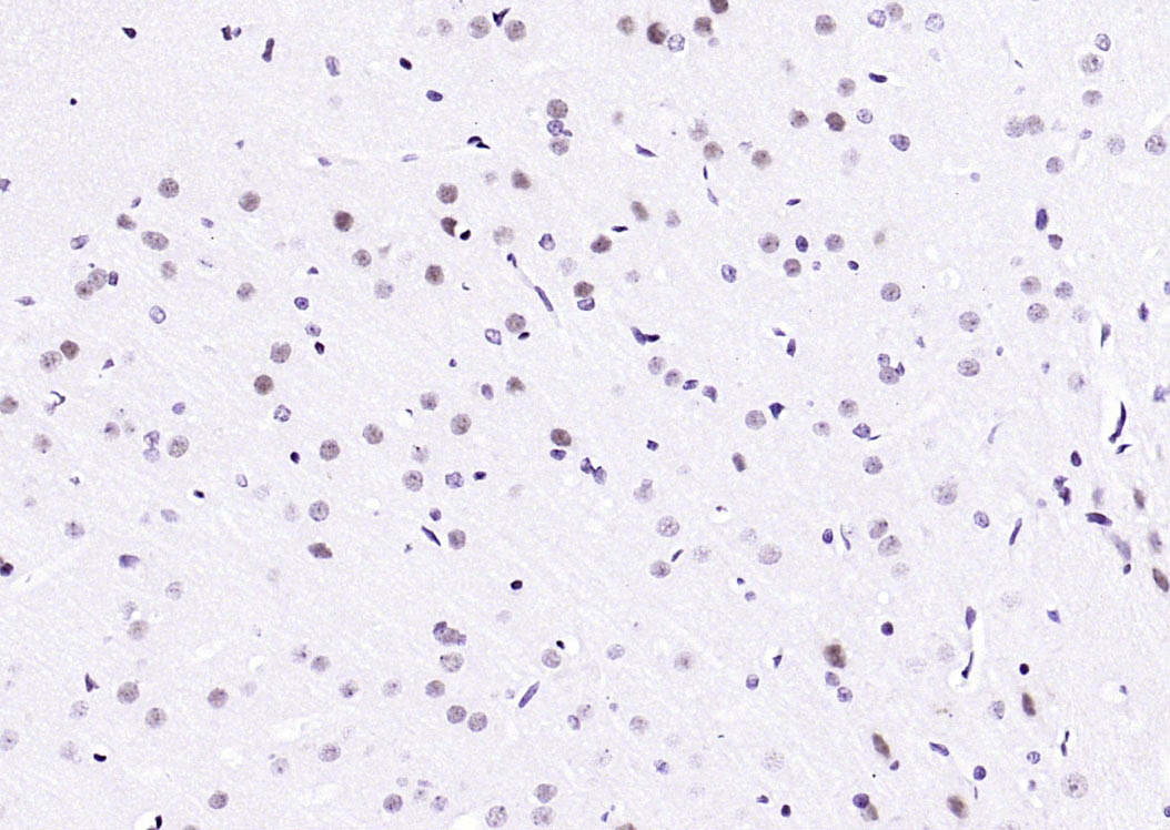 凋亡抑制因子5抗体-bs-1252R