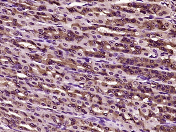 磷酸化β-肌动蛋白抗体-bs-12581R