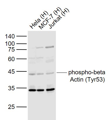 phospho-beta Actin (Tyr53) Rabbit pAb (一抗) | Bioss