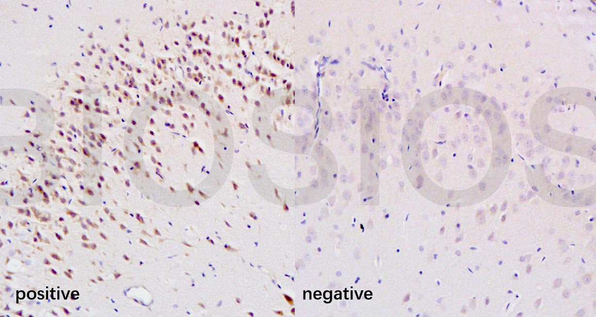 8-OHdG (DNA/RNA Damage) Rabbit pAb (一抗) - IHC-P,IHC-F,IF | Bioss