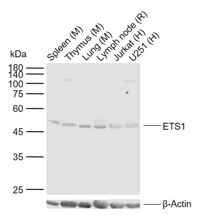 ETS1 Rabbit pAb (一抗) - WB,IHC-P,IHC-F,IF,Flow-Cyt | Bioss
