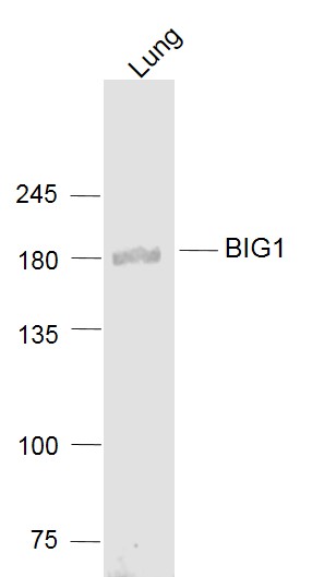 BIG1 Rabbit pAb (一抗) | Bioss