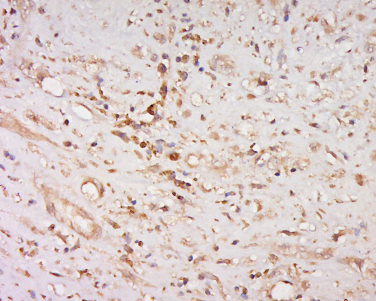 phospho-BNIP3 (Ser95) Rabbit pAb (一抗) | Bioss