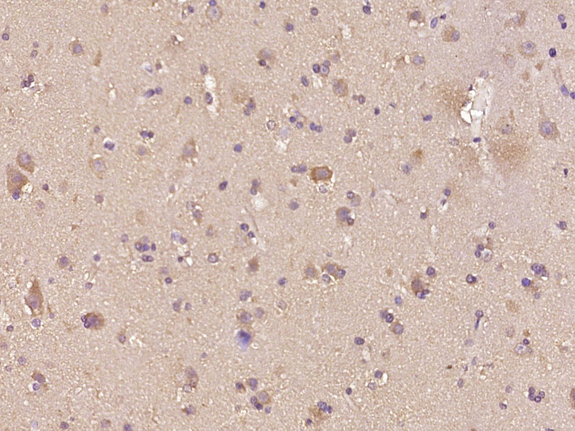 磷酸化促凋亡调节蛋白BNIP3抗体-bs-12875R