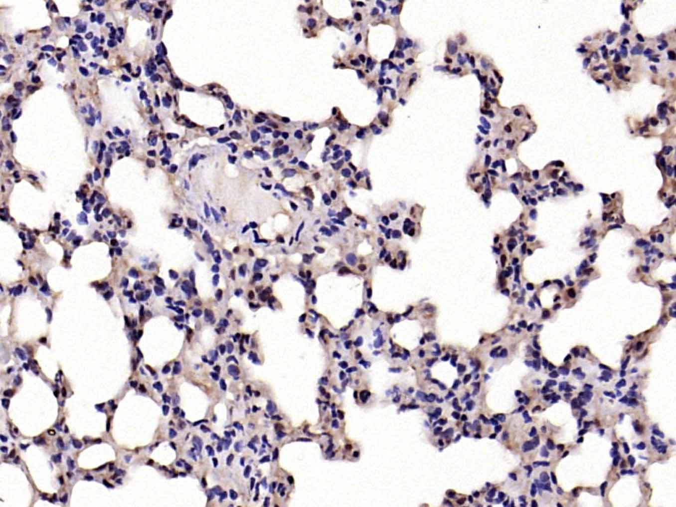 核因子κB抑制蛋白α抗体-bs-1287R