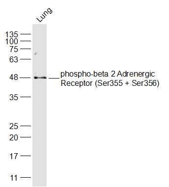 phospho-ADRB2 (Ser355 + Ser356) Rabbit pAb (一抗) | Bioss