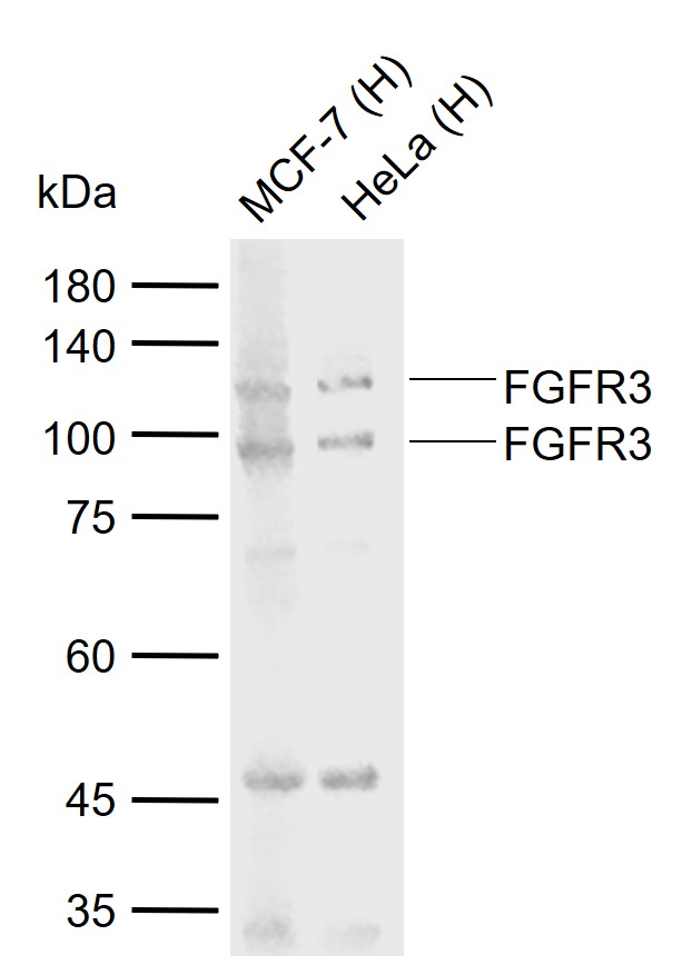 FGFR3 Rabbit pAb (一抗) | Bioss