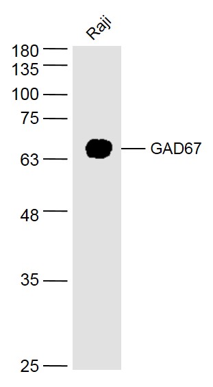 GAD67 Rabbit pAb (一抗) | Bioss
