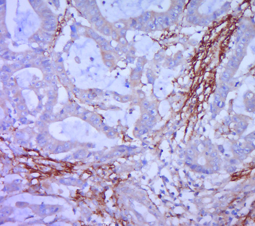 多配体蛋白聚糖1(CD138)抗体-bs-1309R