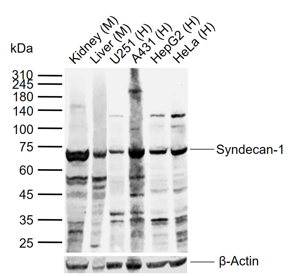 多配体蛋白聚糖1(CD138)抗体-bs-1309R