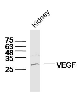 VEGFA Rabbit pAb (一抗) | Bioss