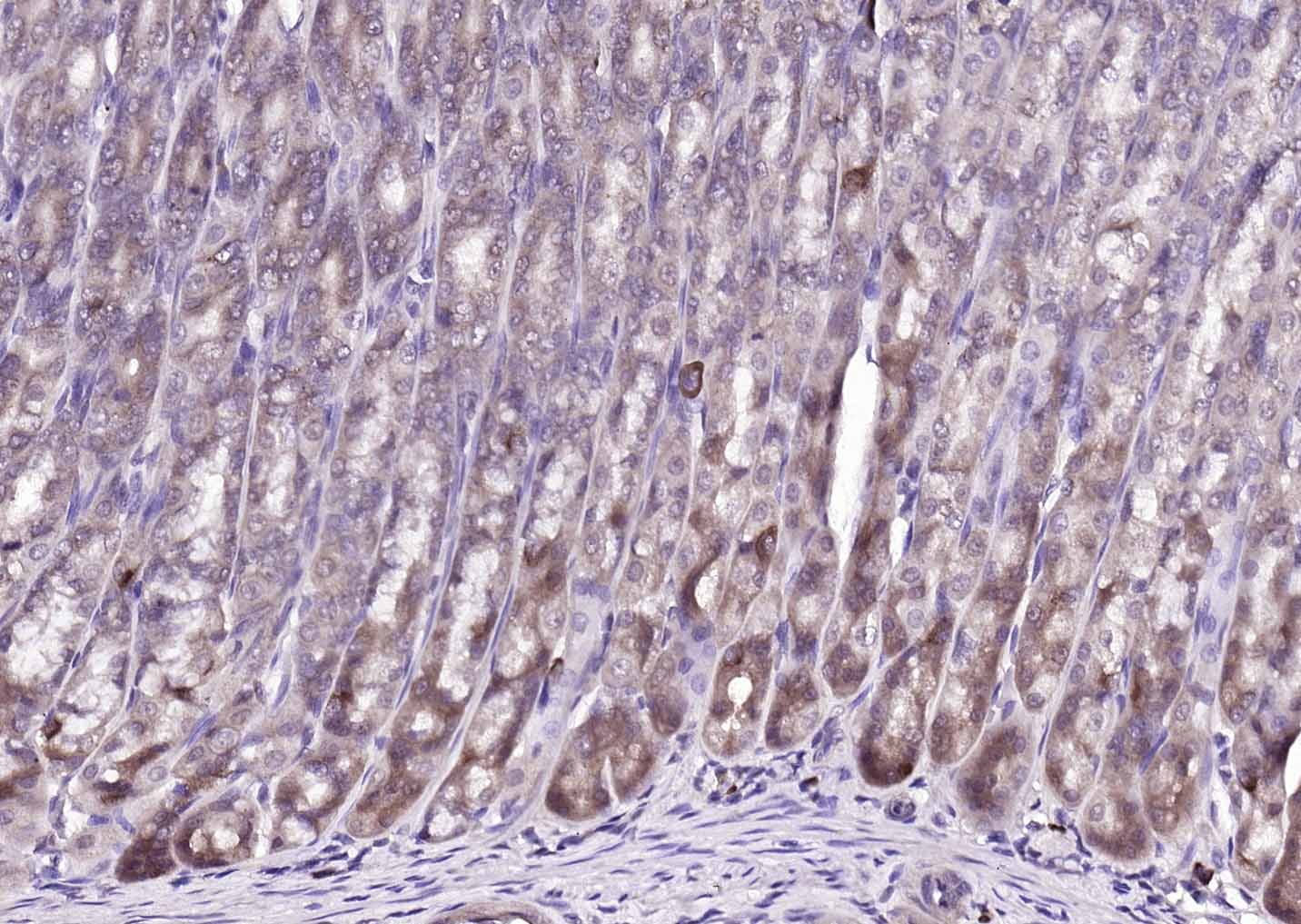 FBXO2 Rabbit pAb (一抗) | Bioss