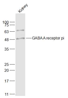 GABA A receptor pi Rabbit pAb (一抗) | Bioss