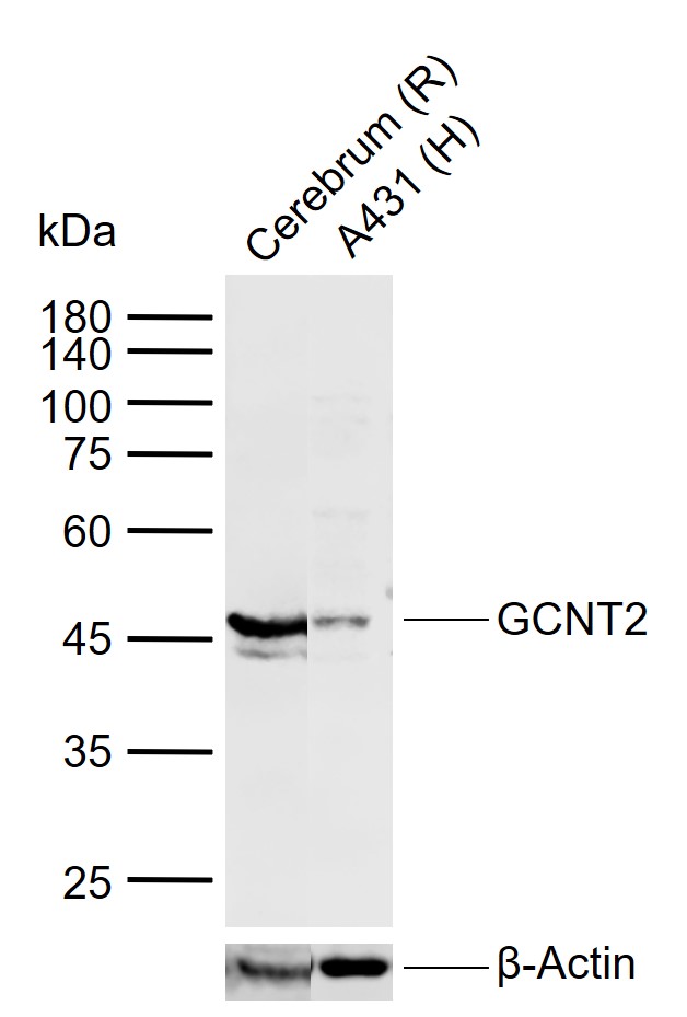 GCNT2 Rabbit pAb (一抗) - WB | Bioss
