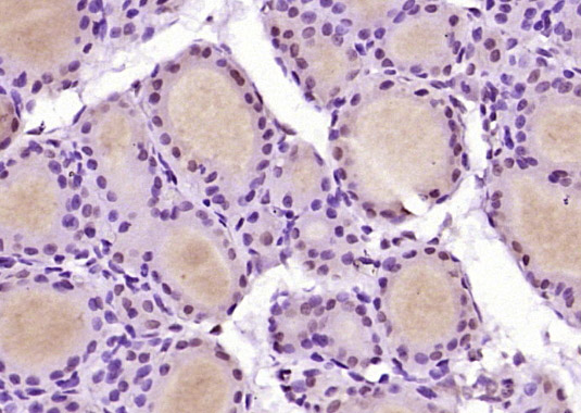 β-抑制蛋白2抗体/β休止蛋白2/β-arrestin抗体-bs-1332R