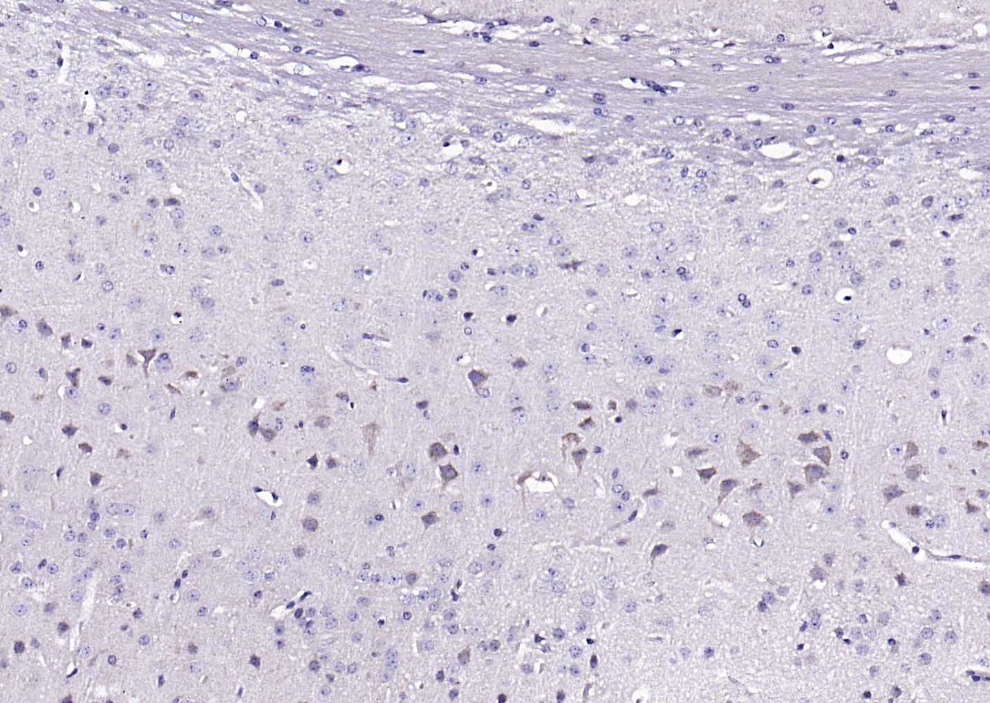 β-抑制蛋白2抗体/β休止蛋白2/β-arrestin抗体-bs-1332R