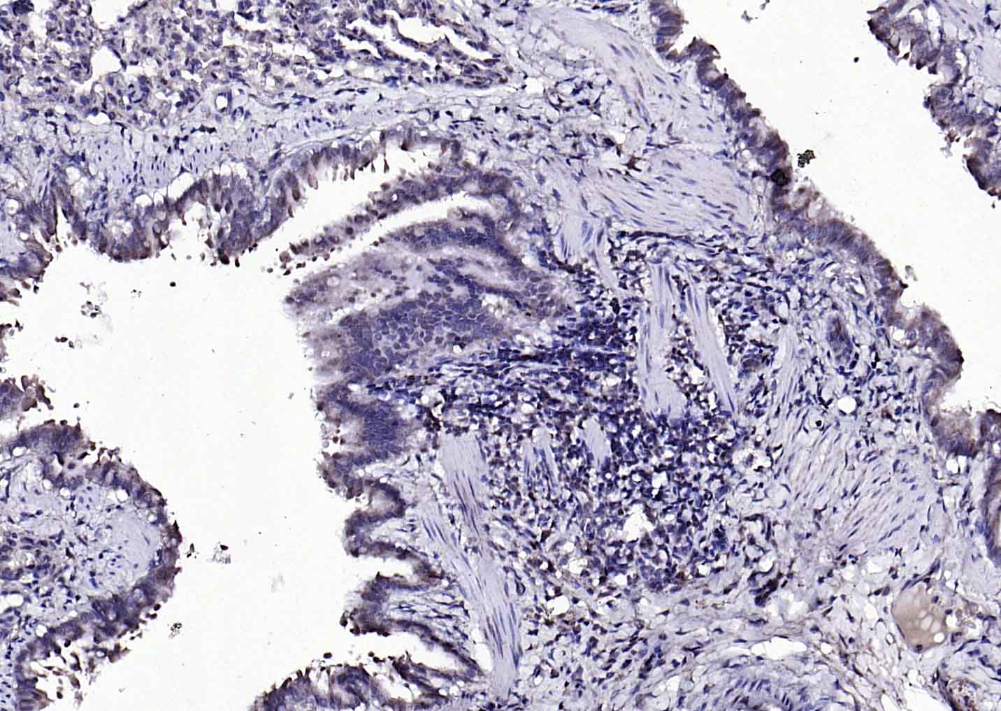 β-抑制蛋白2抗体/β休止蛋白2/β-arrestin抗体-bs-1332R