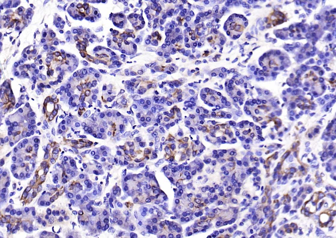 细胞角蛋白18抗体(C端)-bs-1339R