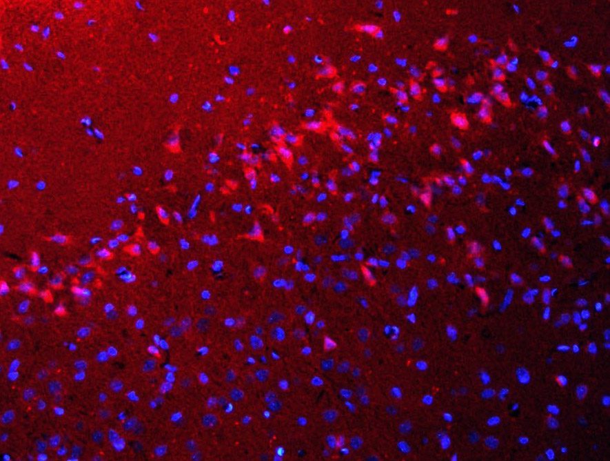 自噬效应蛋白Beclin 1抗体-bs-1353R