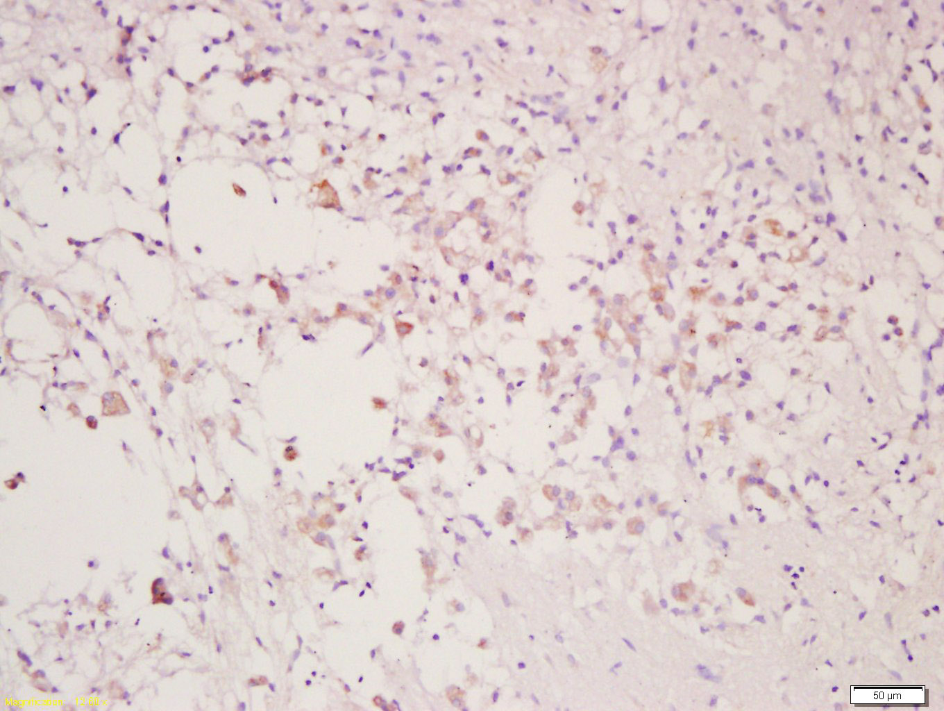 C型凝集素结构域家族9成员A抗体