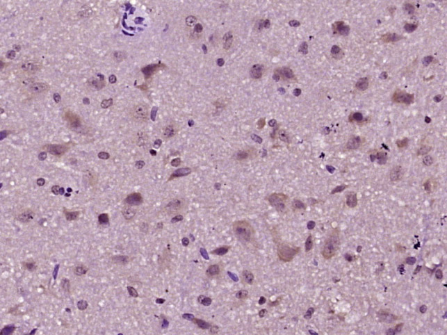 phospho-14-3-3 beta + zeta (Ser186 / Ser184) Rabbit pAb (一抗) | Bioss