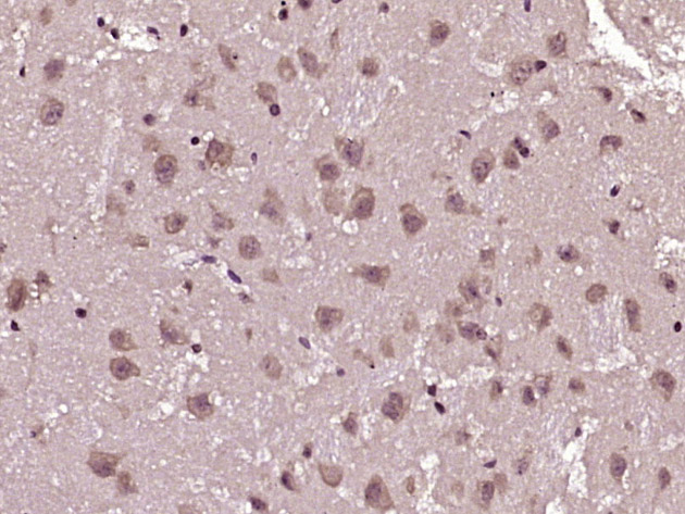 磷酸化14-3-3 β/ζ抗体-bs-13773R
