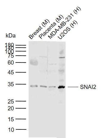 SNAI2 Rabbit pAb (一抗) - WB,IHC-P,IHC-F,IF,Flow-Cyt | Bioss