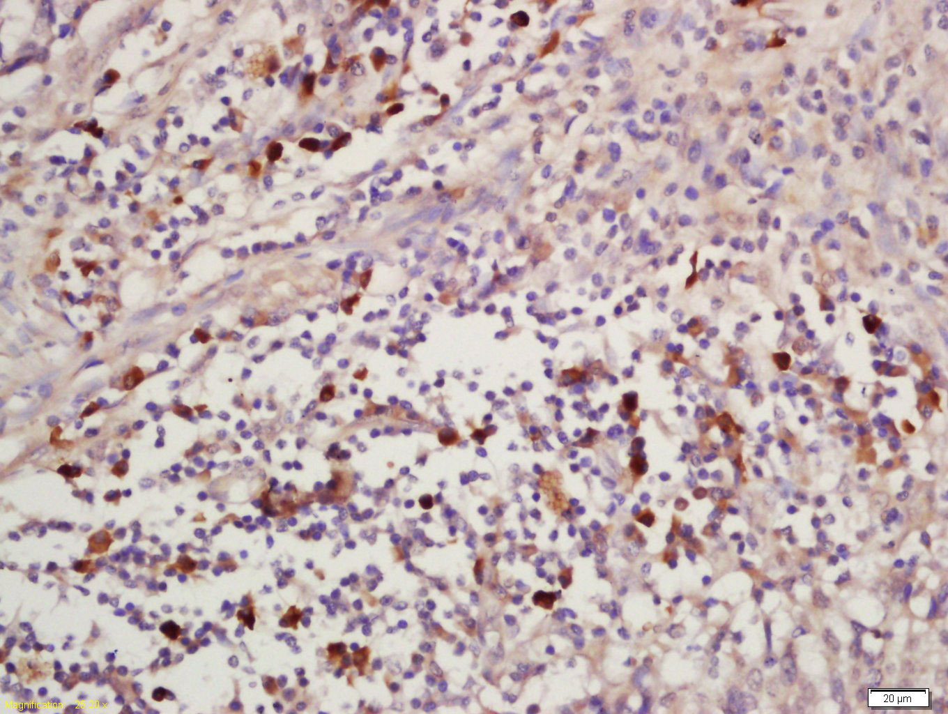 中心体蛋白CEP120抗体-bs-13850R