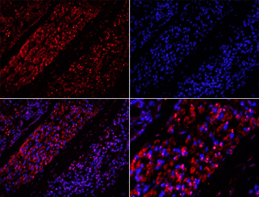 中心体蛋白CEP120抗体-bs-13850R