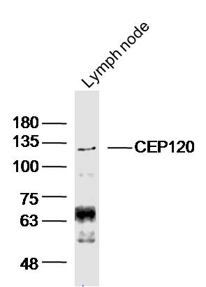 CEP120 Rabbit pAb (一抗) | Bioss
