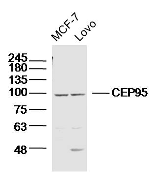 CEP95 Rabbit pAb (一抗) | Bioss