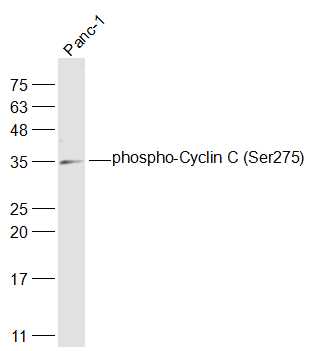 磷酸化周期素C抗体-bs-14136R