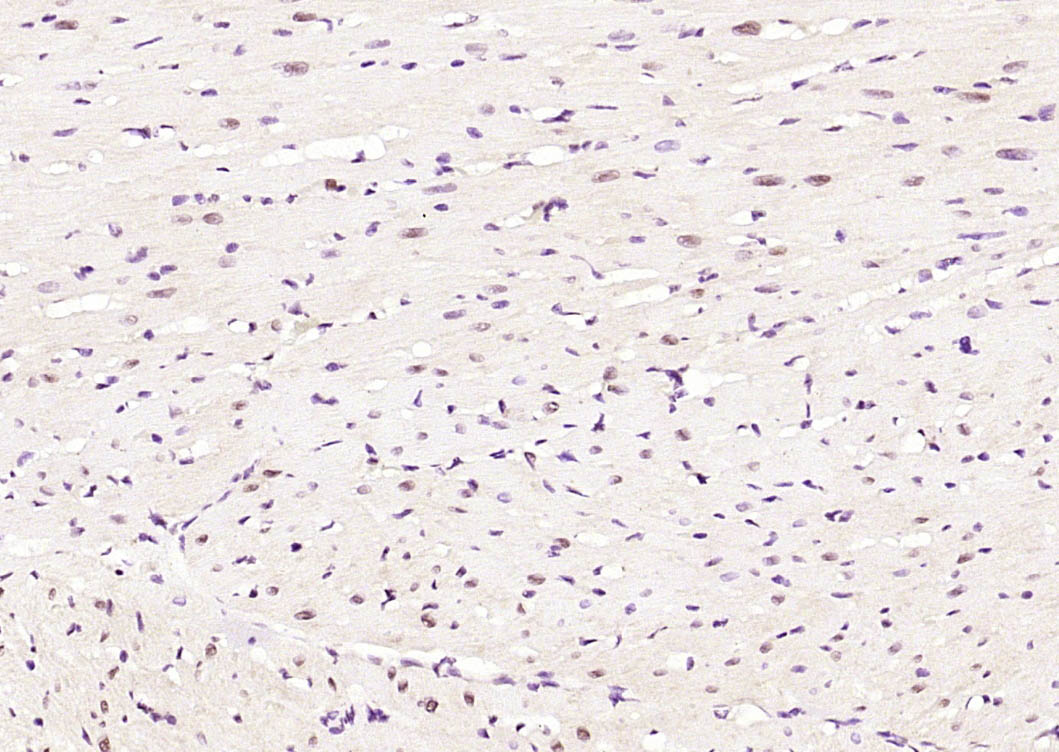 磷酸化周期素C抗体-bs-14136R