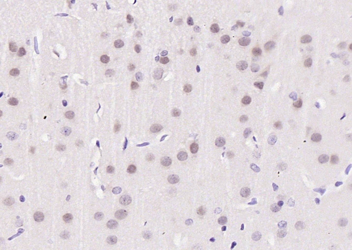 磷酸化周期素C抗体-bs-14136R