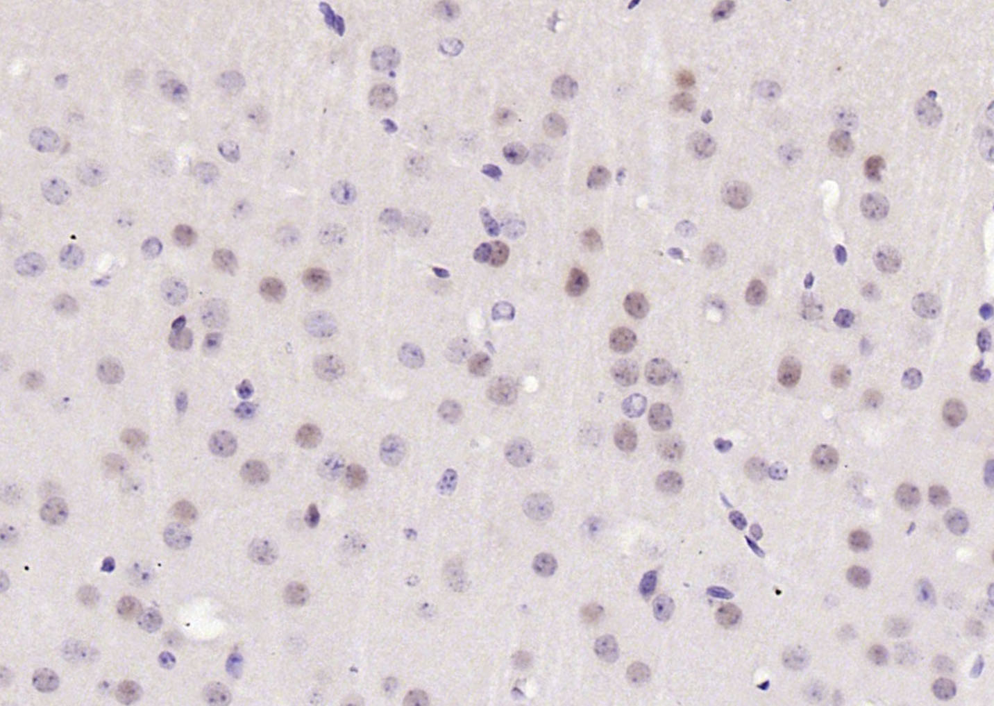 磷酸化周期素C抗体-bs-14136R