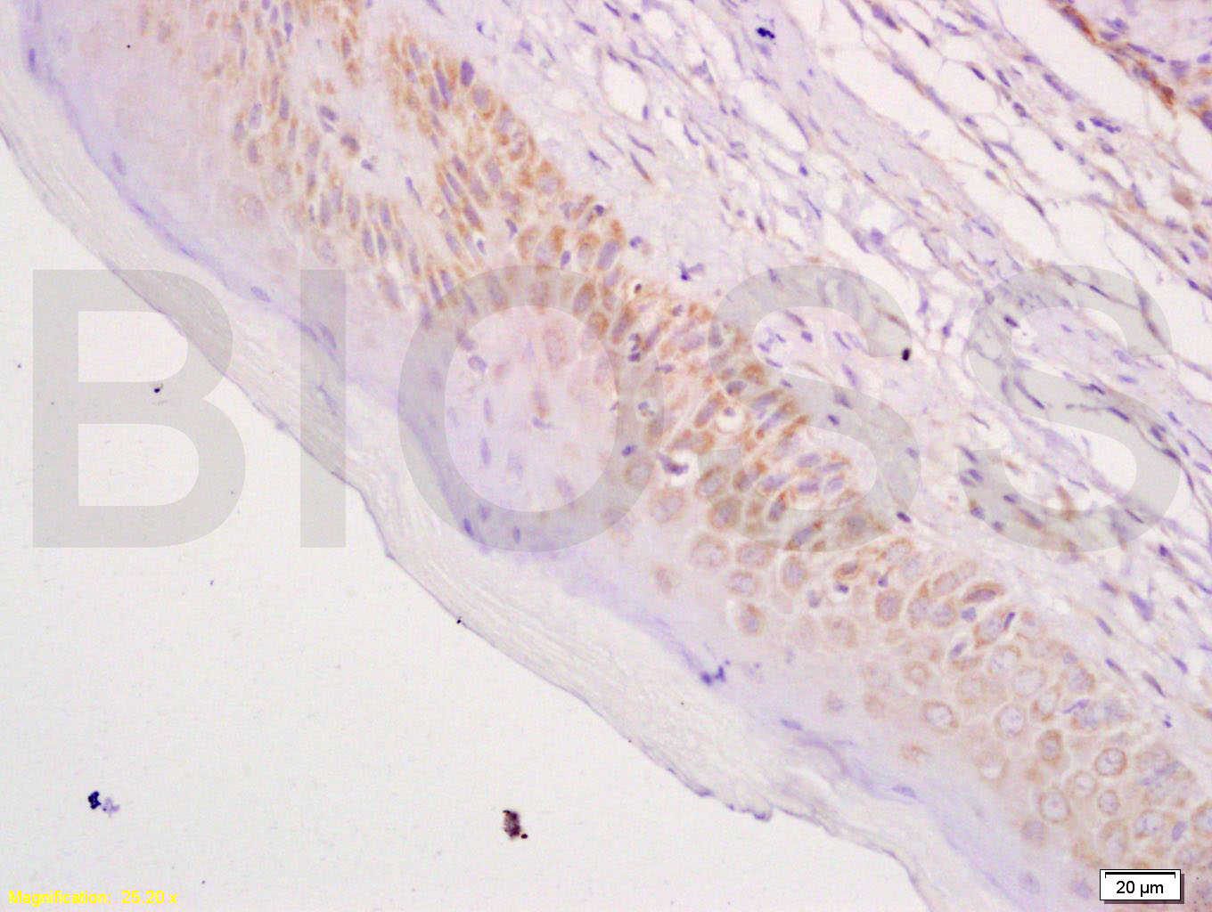 细胞角蛋白17抗体-bs-1431R