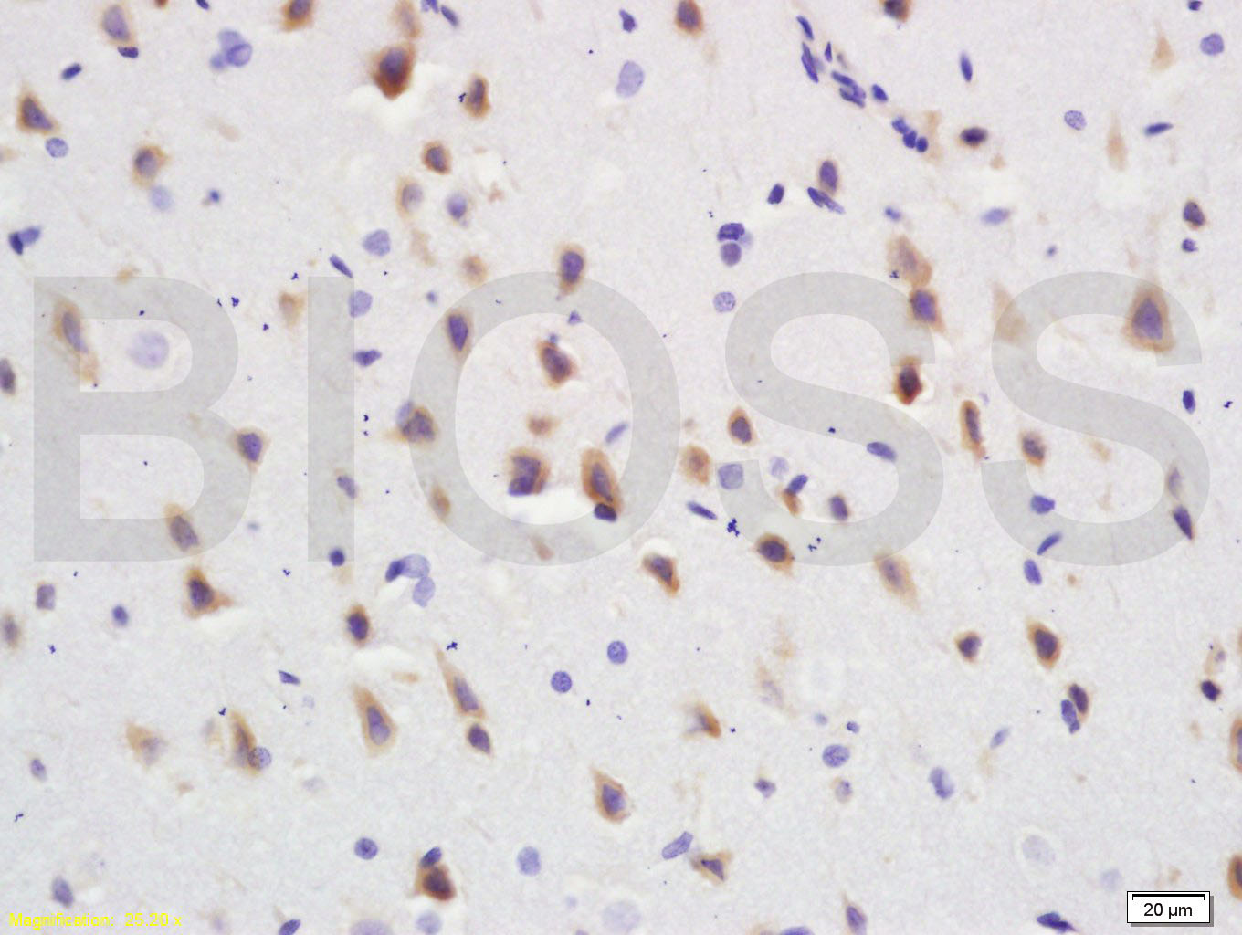 磷脂酰乙醇胺结合蛋白1抗体-bs-1436R